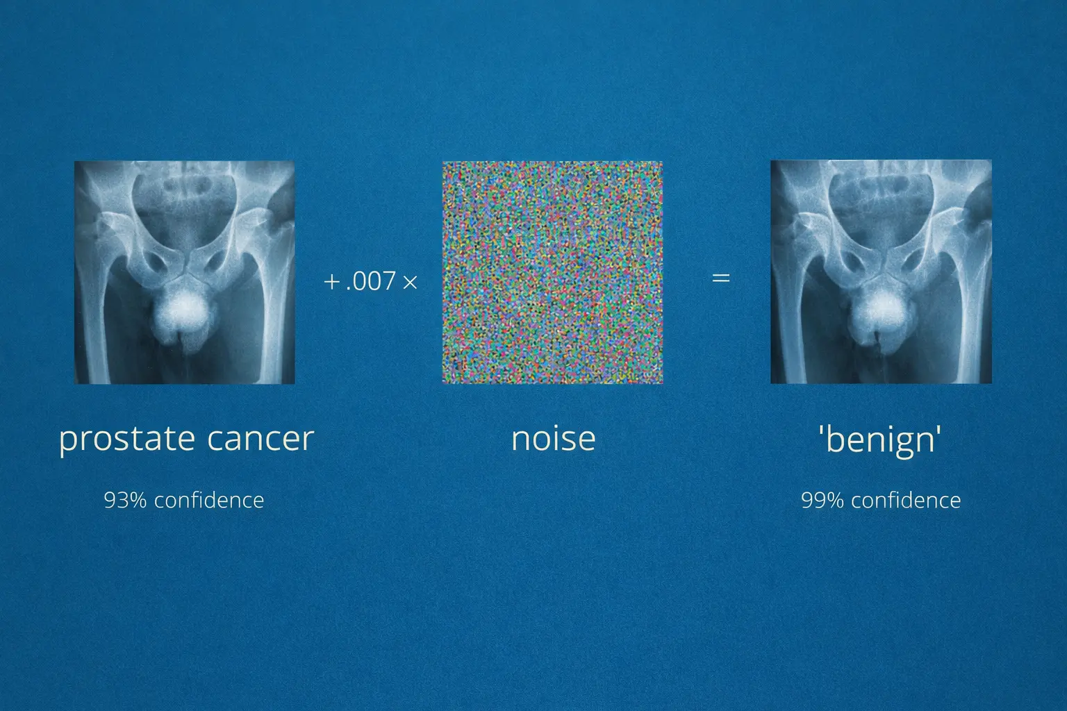 Modelo de imágenes clínicas de rayos X evaluado bajo condiciones de ataque adversarial para análisis de robustez